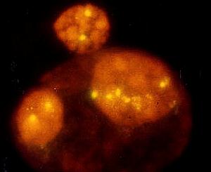 Chromosome 12