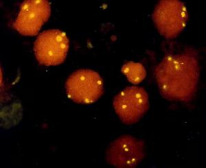 Chromosome 12