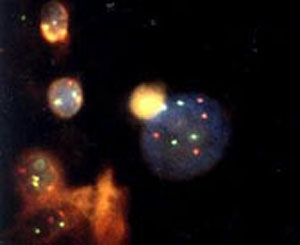 Chromosome 8 and 9