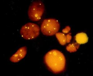 Chromosome 8