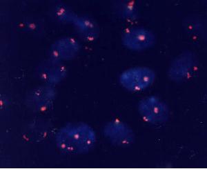 Chromosome 18