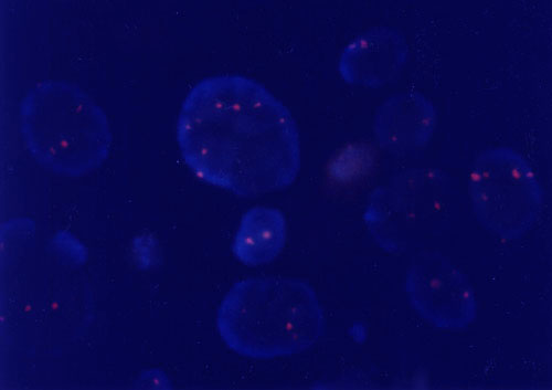 Chromosome 9